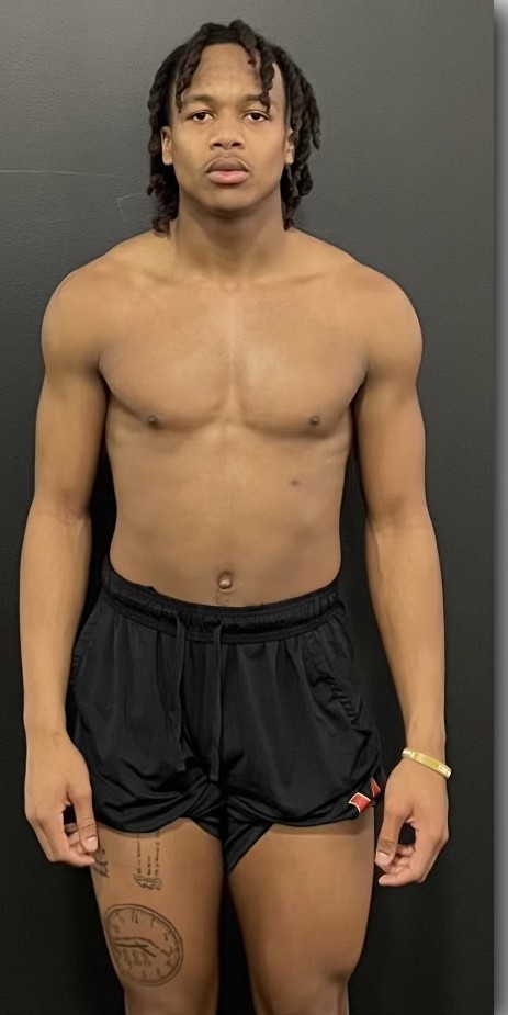 Before transformation